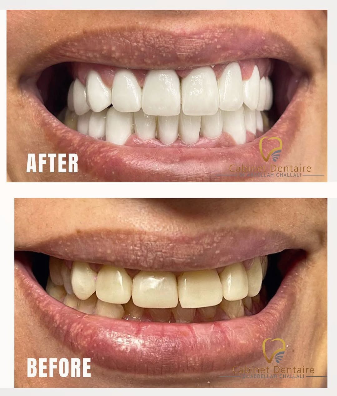 https://docteurchallali.com/wp-content/uploads/2026/04/للإجابة-على-كل-تساؤلاتكم-وحجز-موعد-يمكنكم-الإتصال-مباشرة-بالأرقام-التالية-05366-01813-212676653.jpg